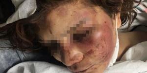 Karısına işkence eden sanığa 34 yıl hapis cezası istemi