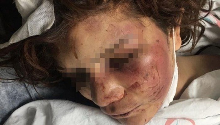 Karısına işkence eden sanığa 34 yıl hapis cezası istemi