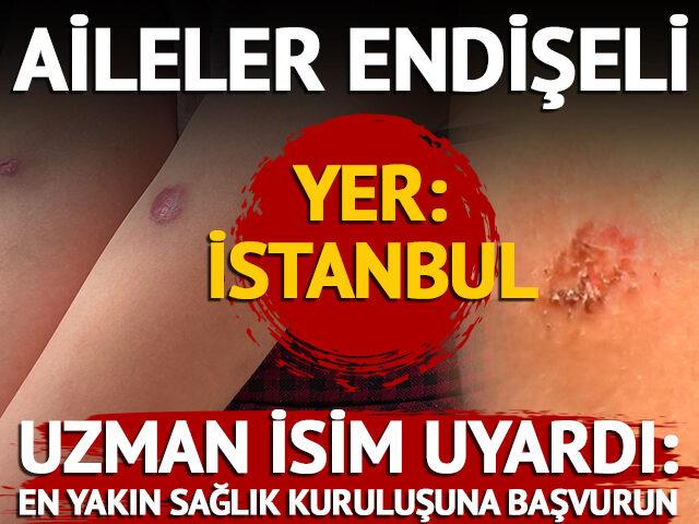 Uzman isim uyardı: En yakın sağlık kuruluşuna başvurun