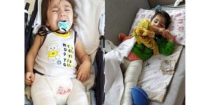 Urfa’da Cam Hastalığına Yakalanan Kardeşler Yardım Bekliyor